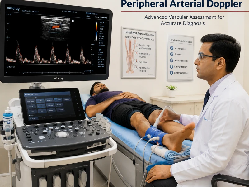 Advanced Peripheral Arterial Doppler Ultrasound Machine